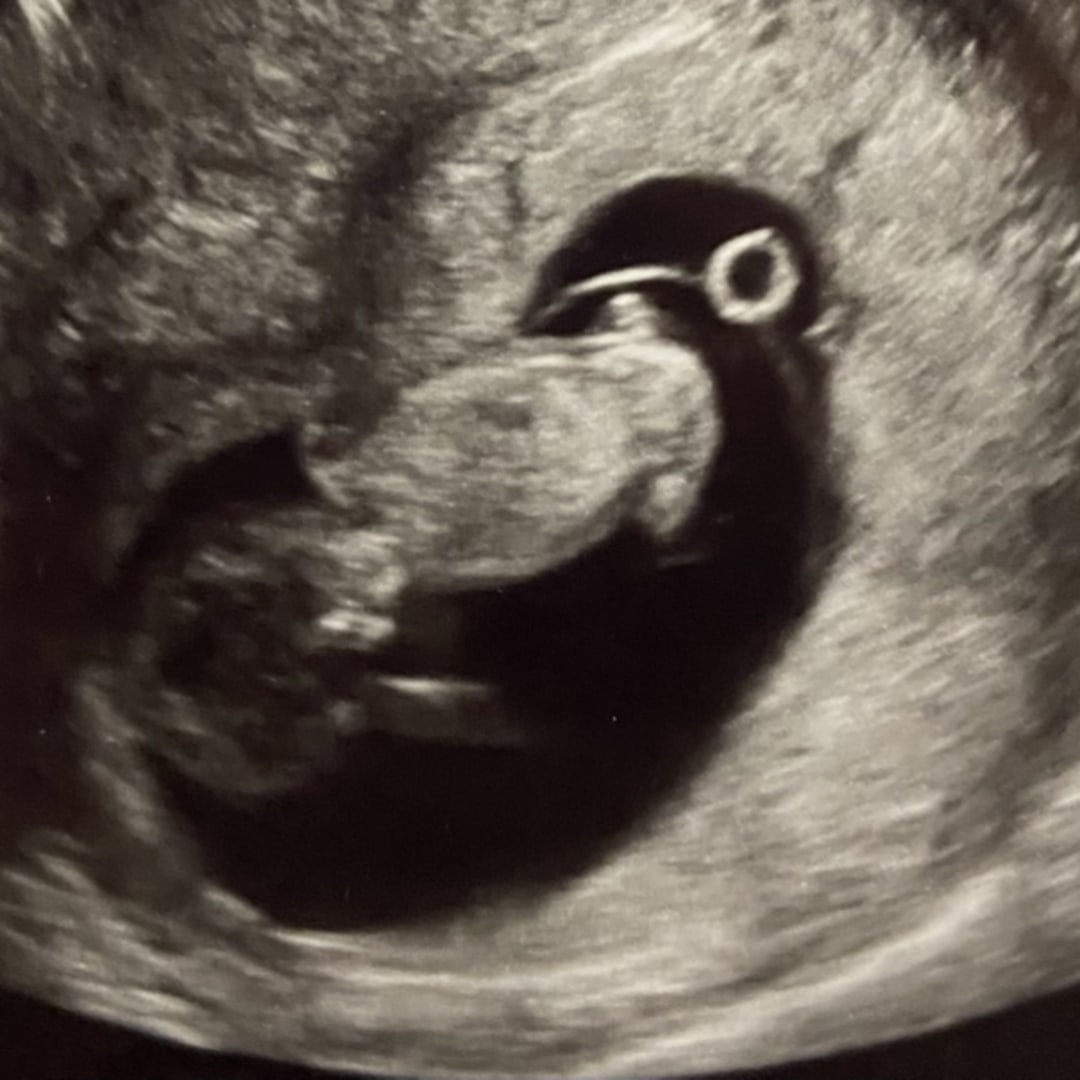 Photo shared by Heather for their Babylist baby registry.