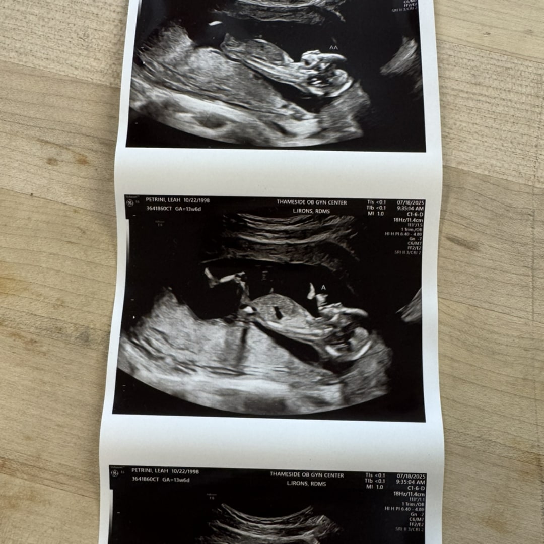 Photo shared by Leah for their Babylist baby registry.