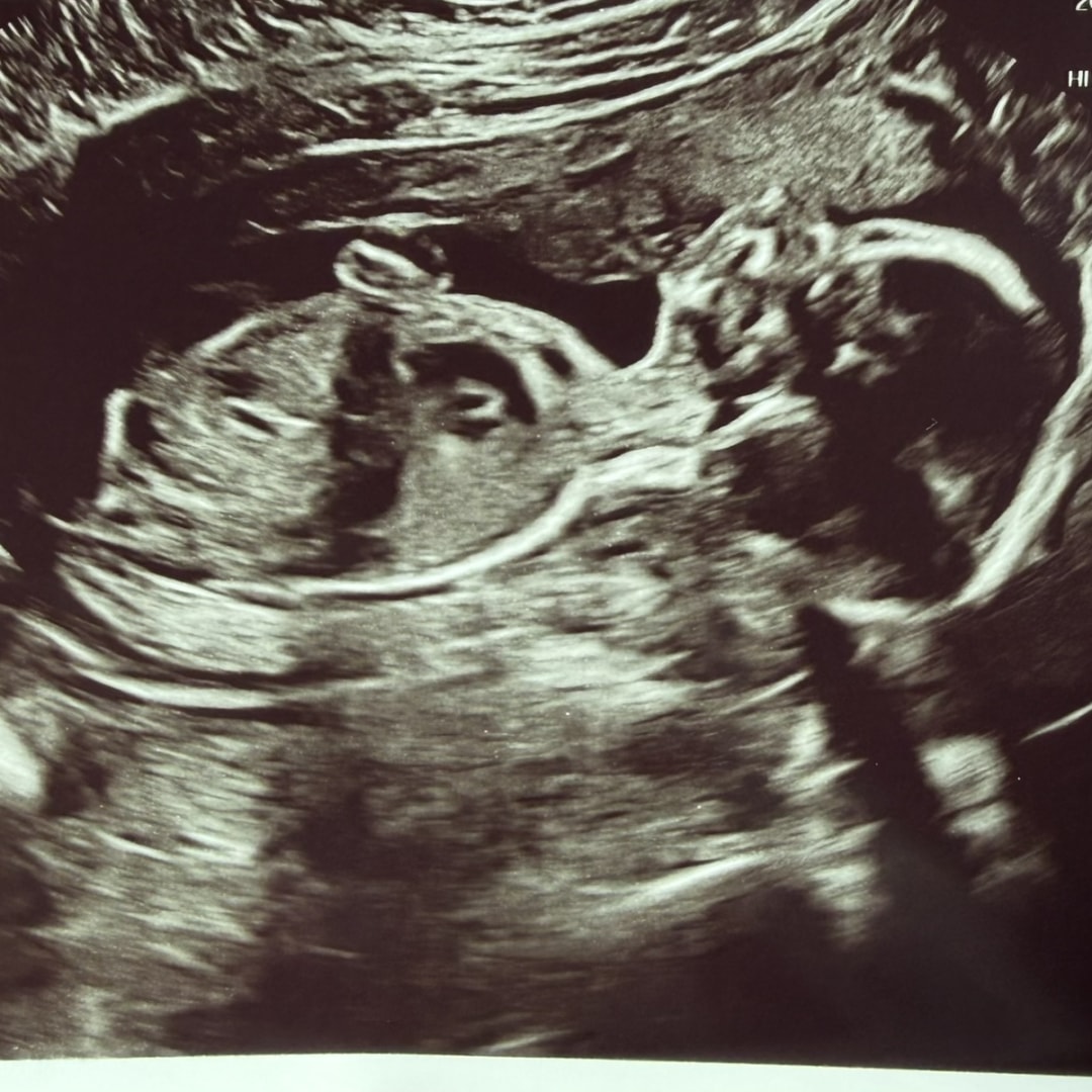 Photo shared by Nicole for their Babylist baby registry.