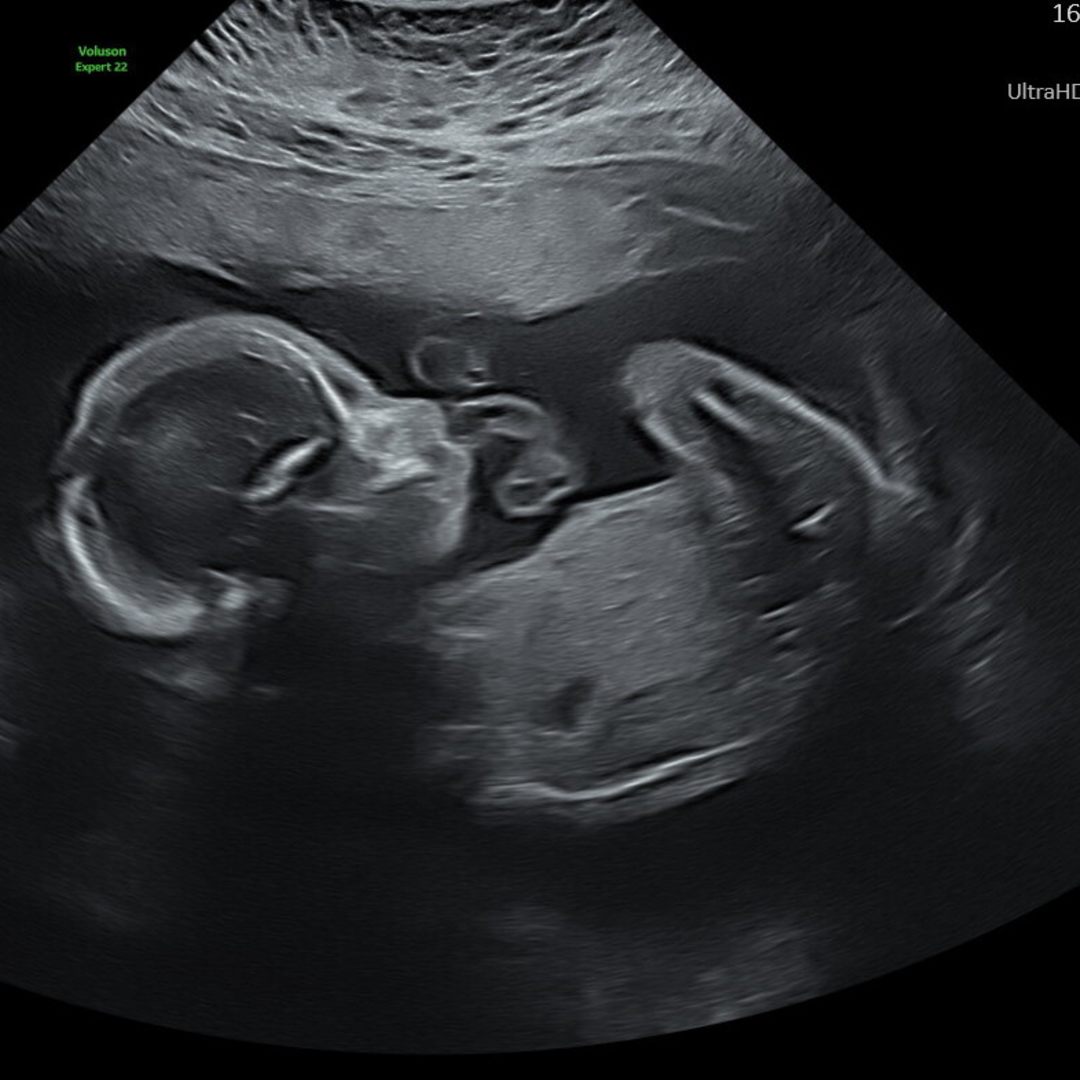 Photo shared by JESSICA for their Babylist baby registry.