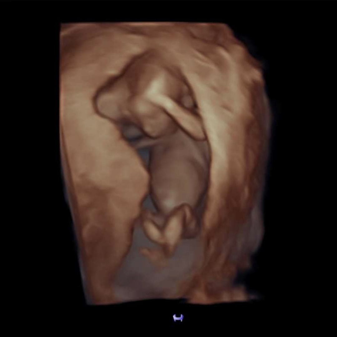 Photo shared by Sally for their Babylist baby registry.
