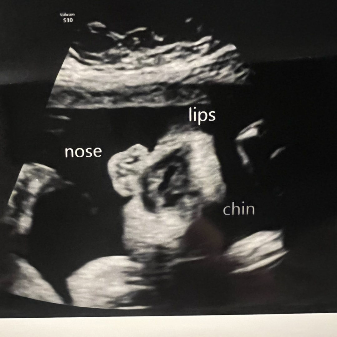 Photo shared by Kendra for their Babylist baby registry.