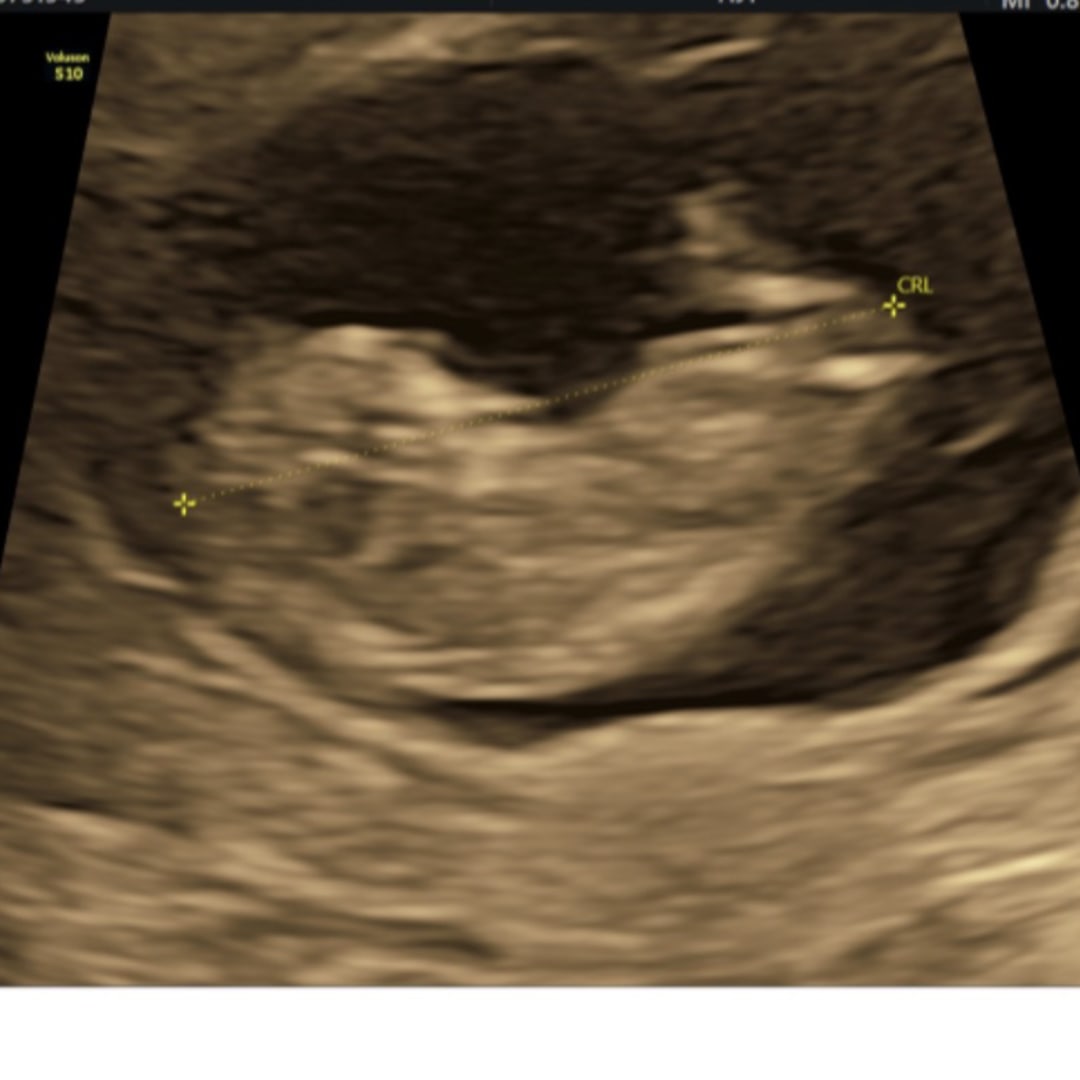 Photo shared by Sydnie for their Babylist baby registry.
