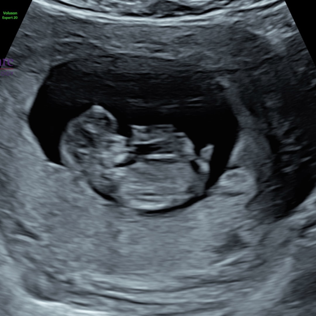 Photo shared by Emily for their Babylist baby registry.