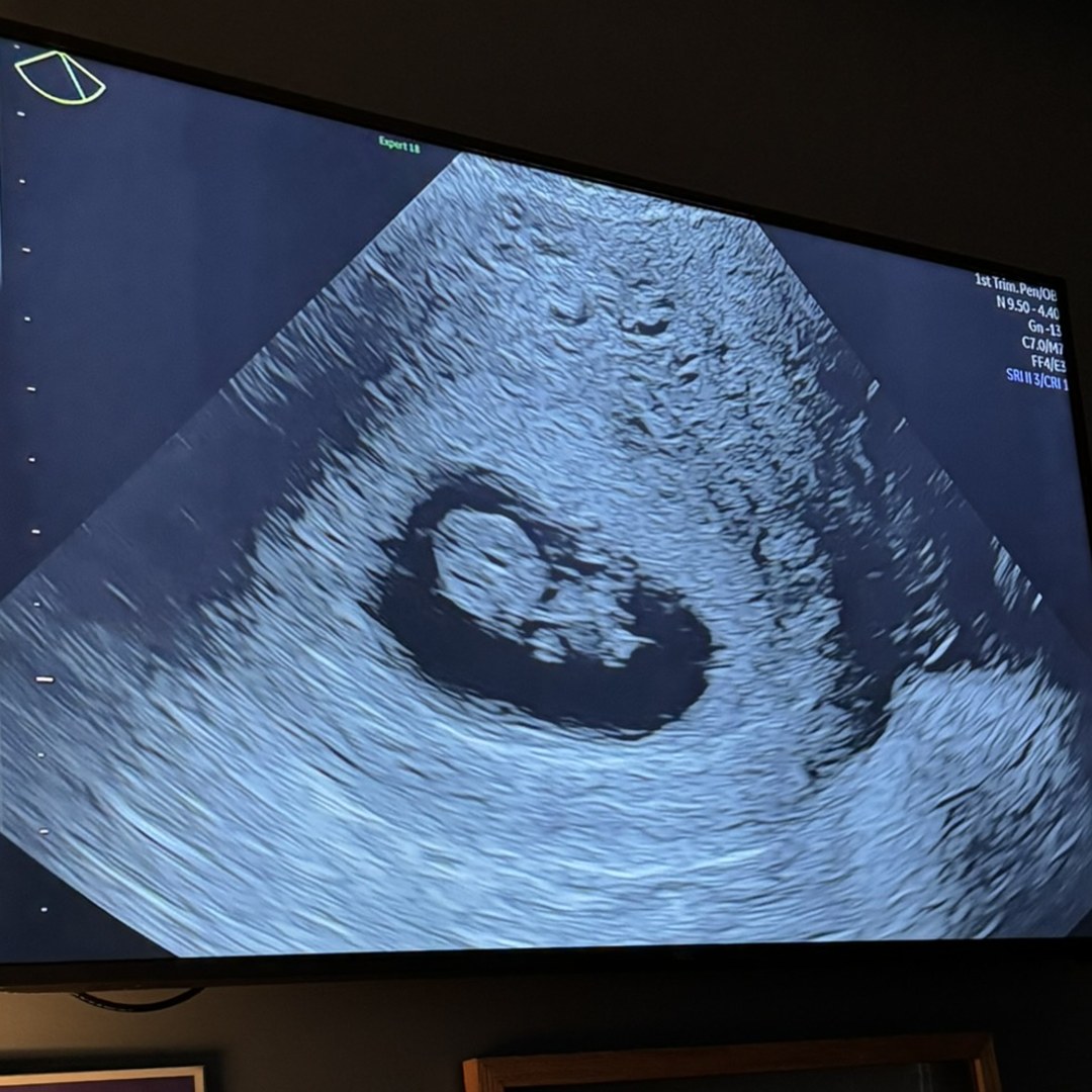 Photo shared by Alexandra for their Babylist baby registry.