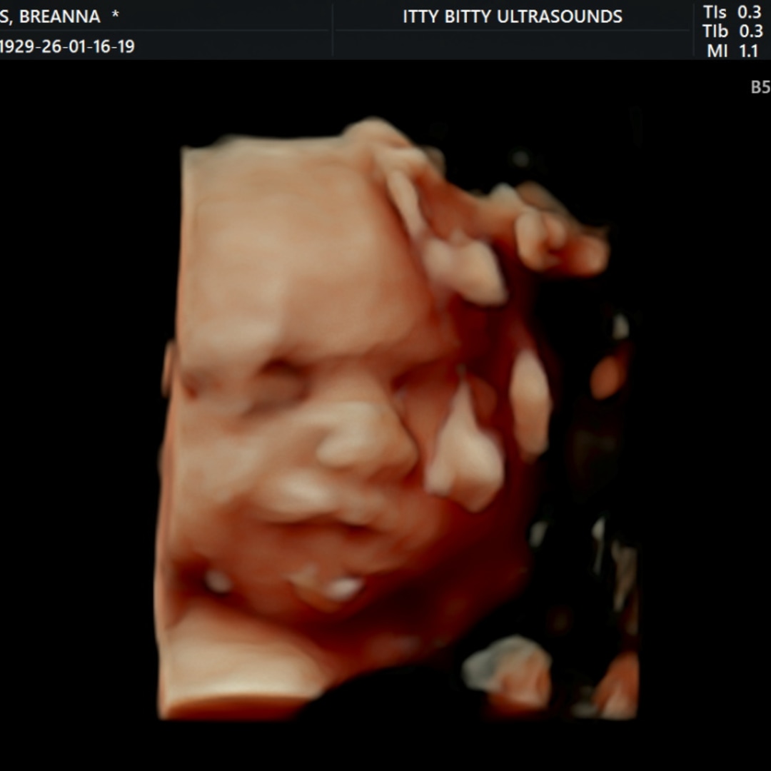 Photo shared by Breanna for their Babylist baby registry.
