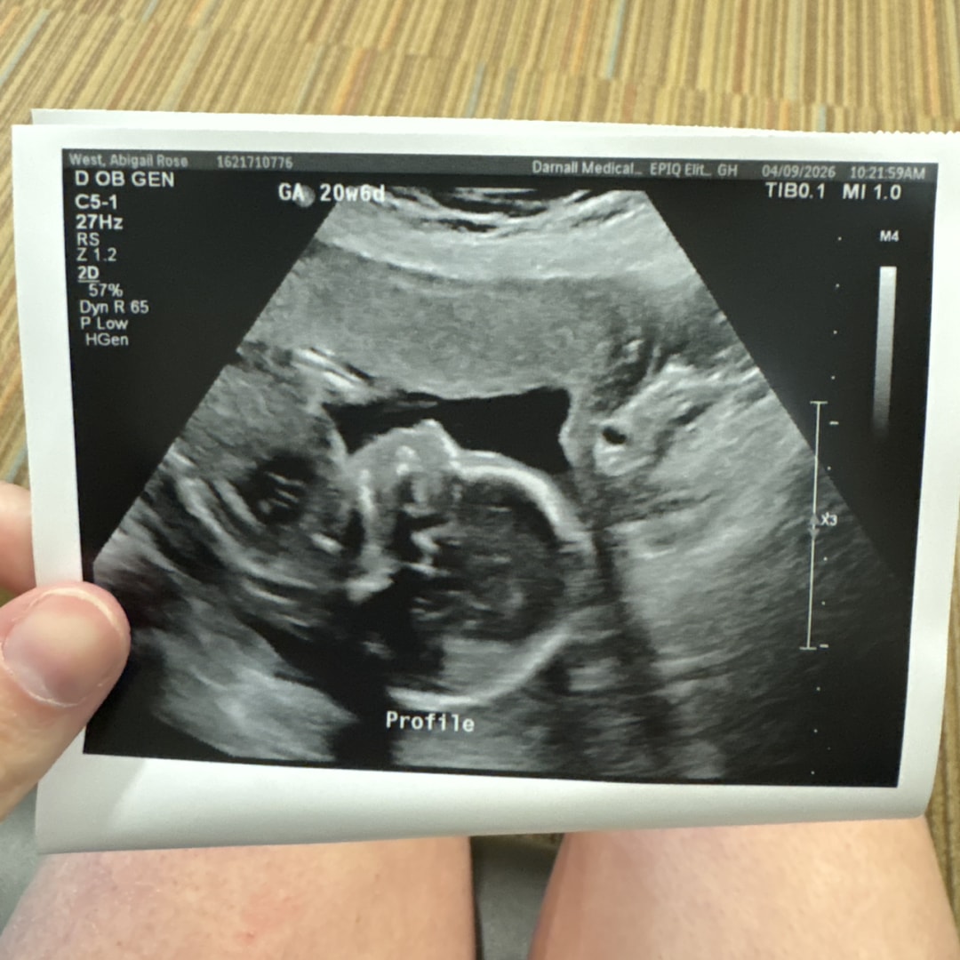 Photo shared by Abbey for their Babylist baby registry.