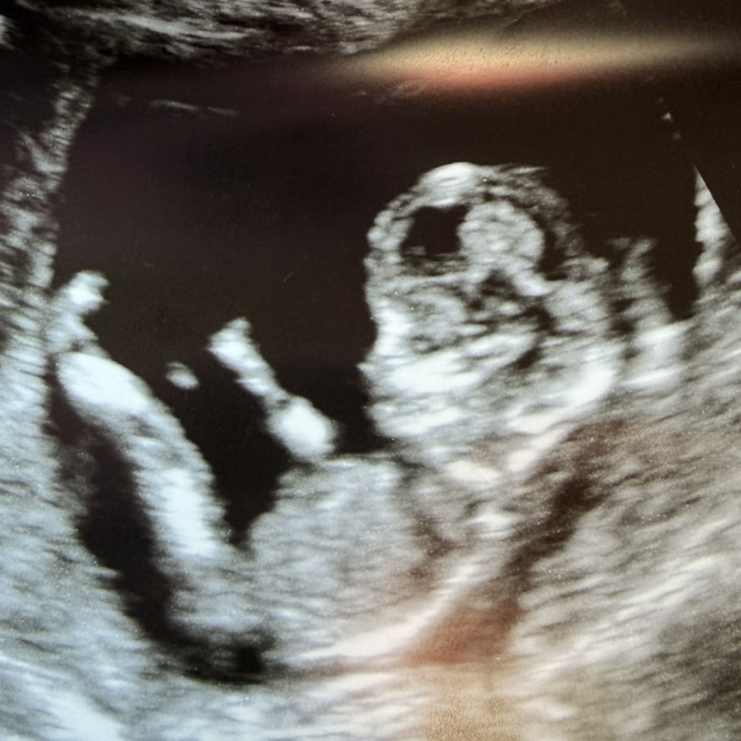 Photo shared by Brittany for their Babylist baby registry.