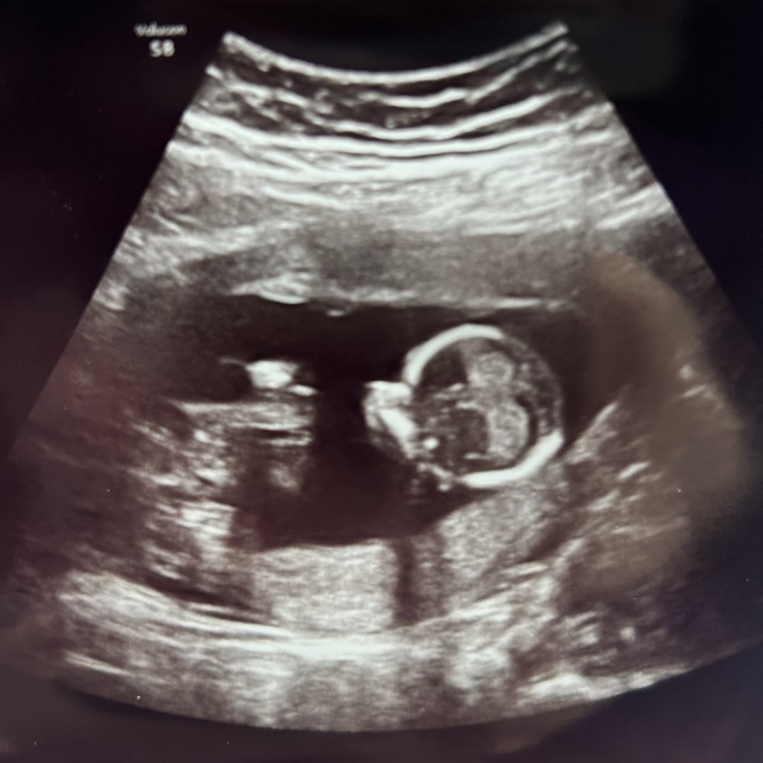 Photo shared by Kaitlynn for their Babylist baby registry.