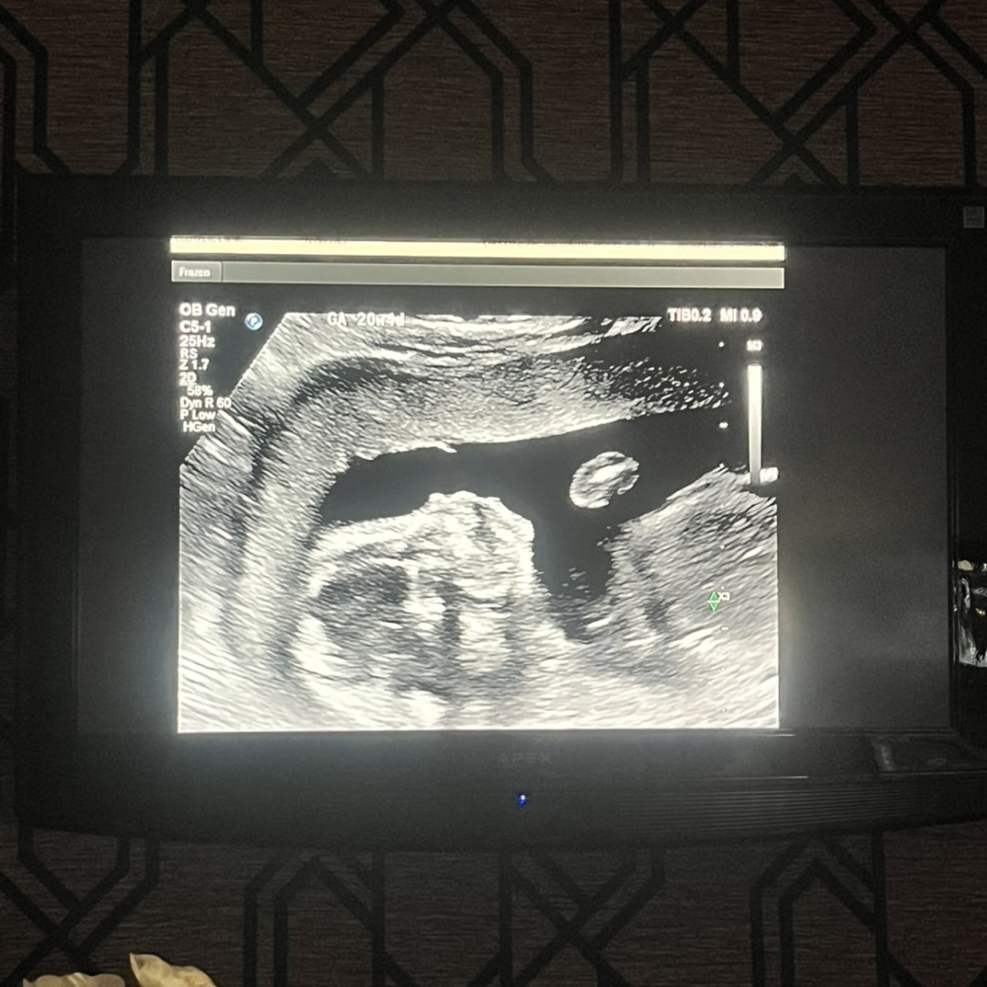 Photo shared by Emma for their Babylist baby registry.