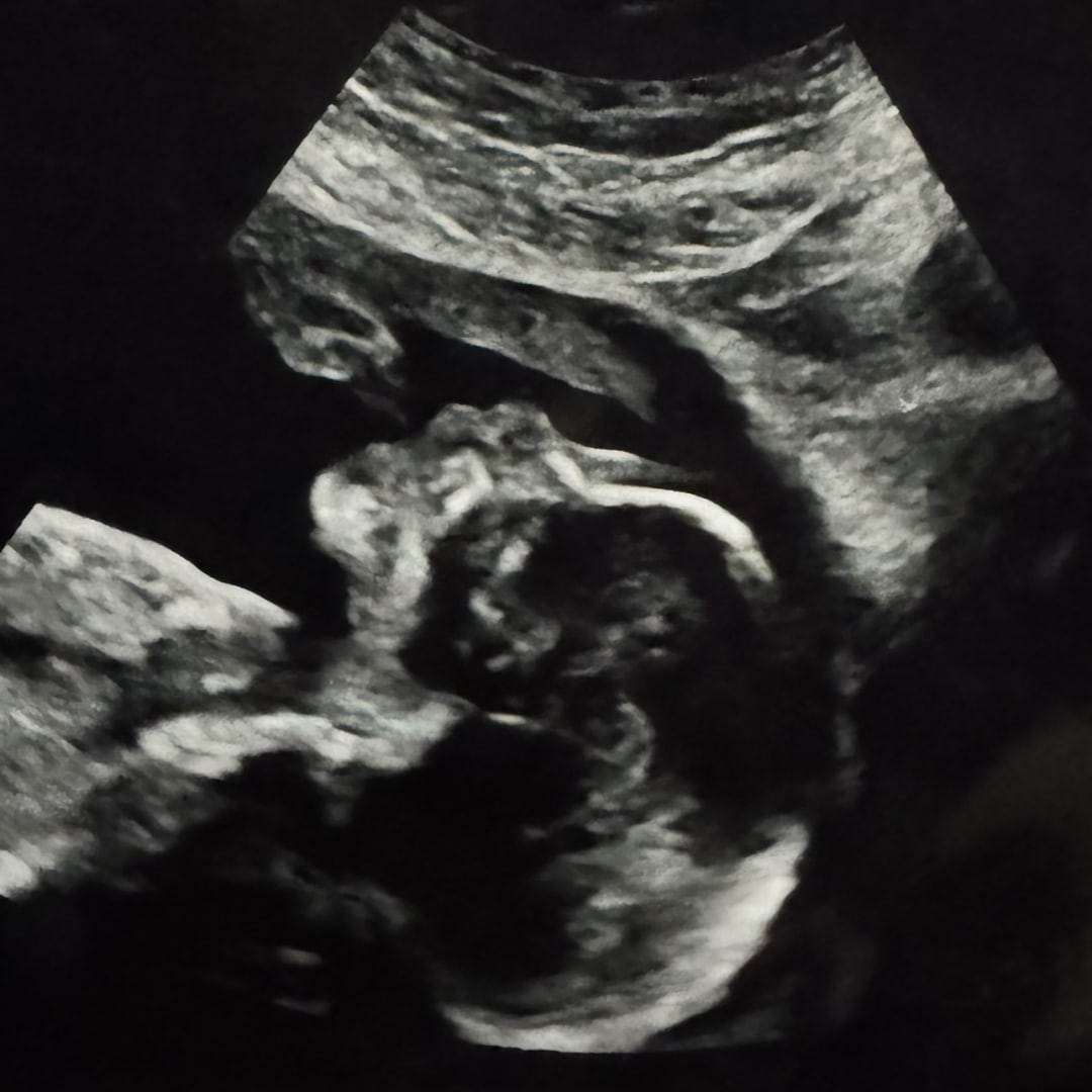 Photo shared by Jenna for their Babylist baby registry.