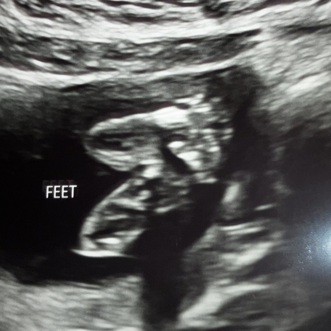 Photo shared by Suhnovian for their Babylist baby registry.