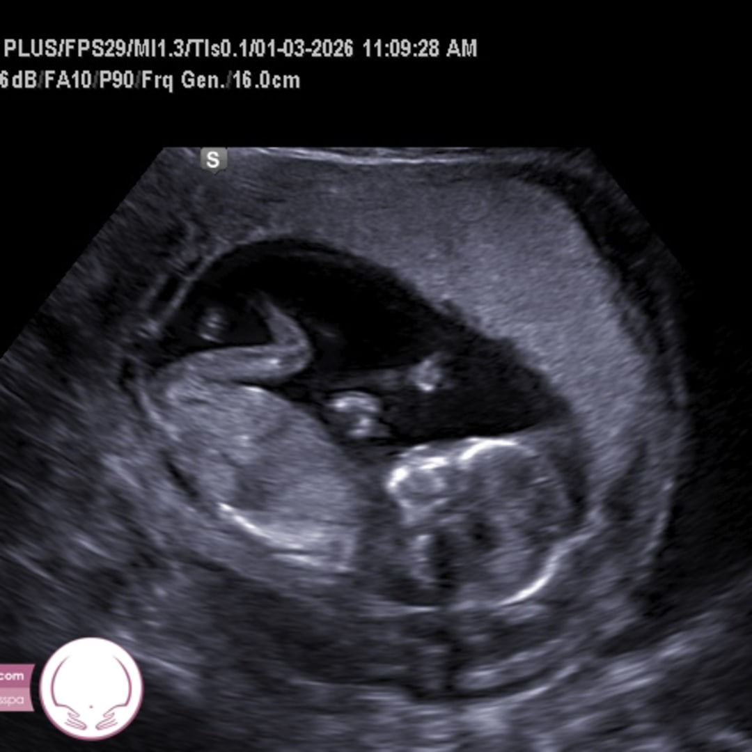 Photo shared by Brianne for their Babylist baby registry.