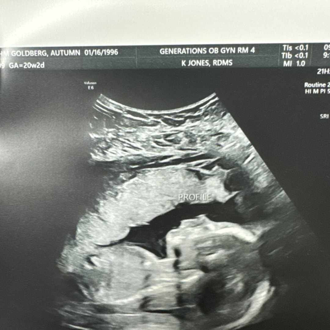 Photo shared by Autumn for their Babylist baby registry.