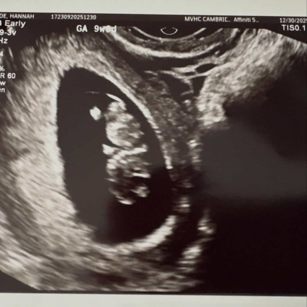 Photo shared by Hannah for their Babylist baby registry.