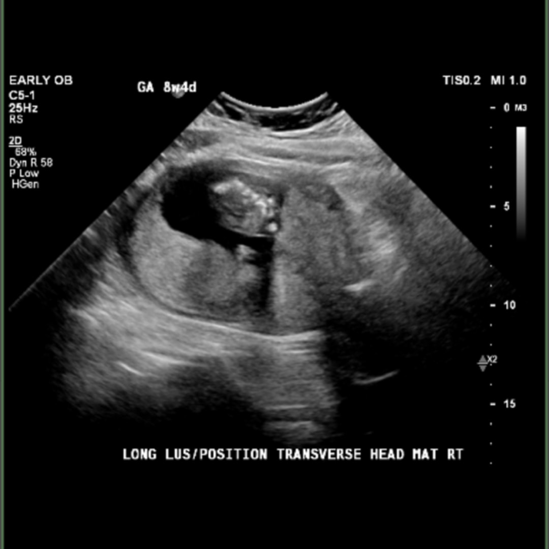 Photo shared by Jade for their Babylist baby registry.