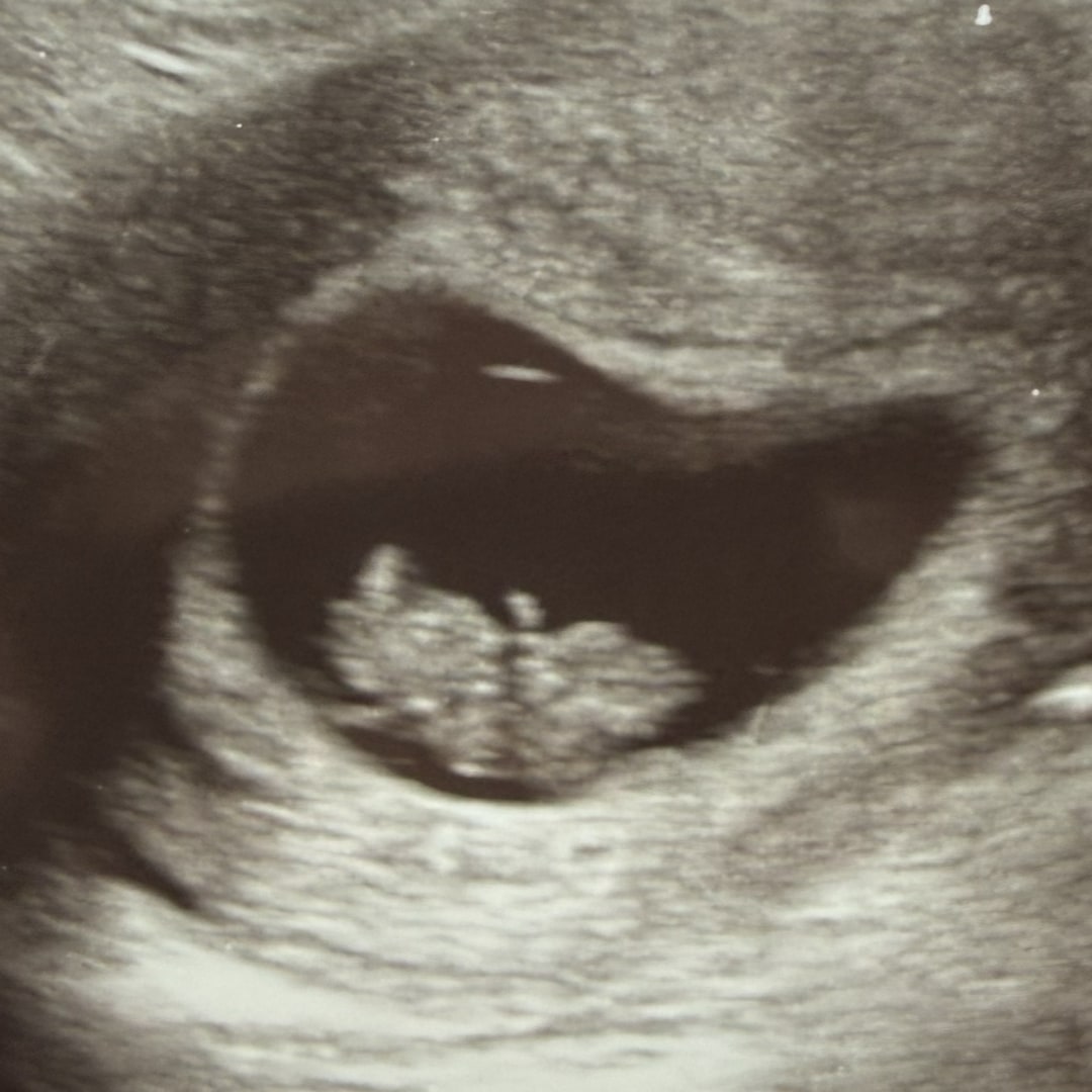 Photo shared by Breanne for their Babylist baby registry.