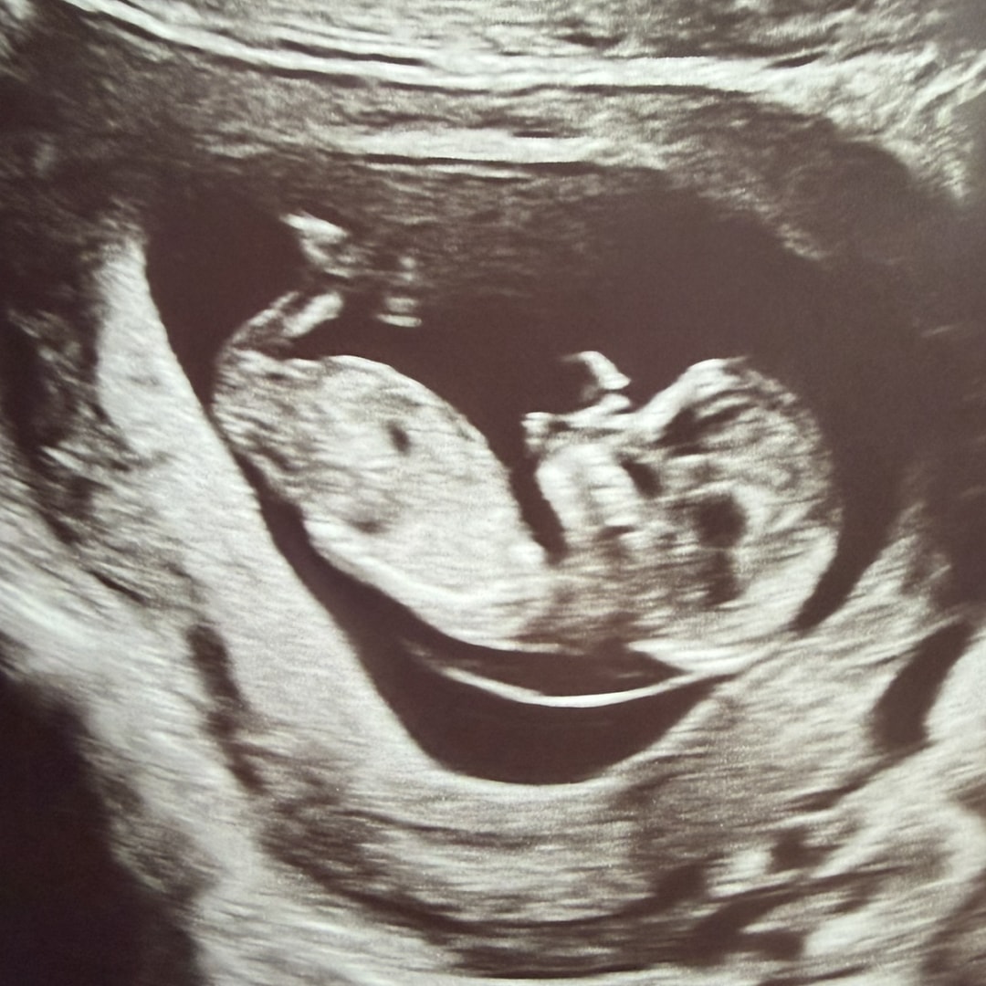 Photo shared by Riley for their Babylist baby registry.