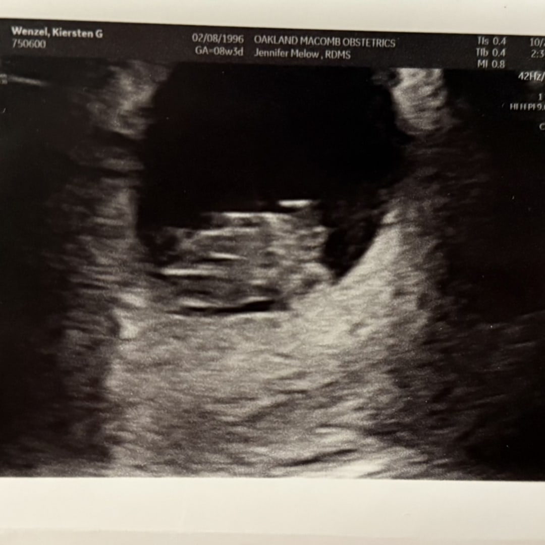 Photo shared by Kiersten for their Babylist baby registry.