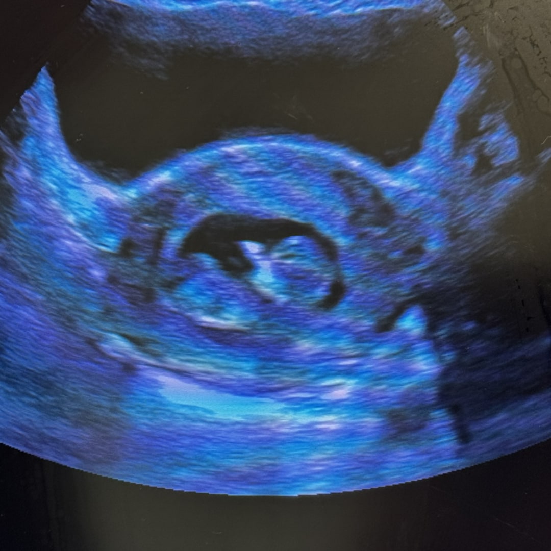 Photo shared by Savannah for their Babylist baby registry.