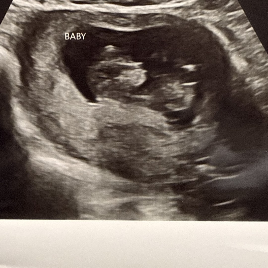Photo shared by Naomi for their Babylist baby registry.