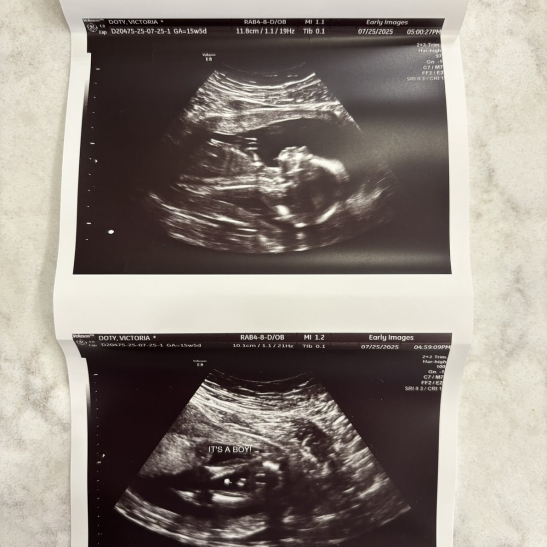 Photo shared by Victoria for their Babylist baby registry.