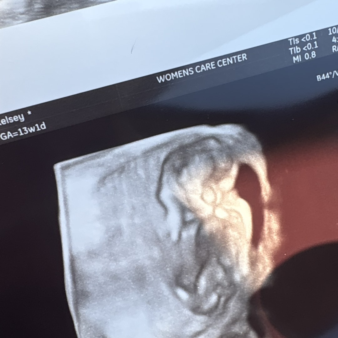 Photo shared by Kelsey for their Babylist baby registry.