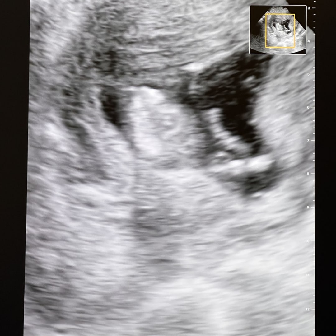 Photo shared by Cassidy for their Babylist baby registry.