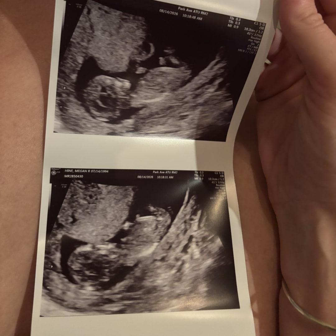 Photo shared by Megan for their Babylist baby registry.