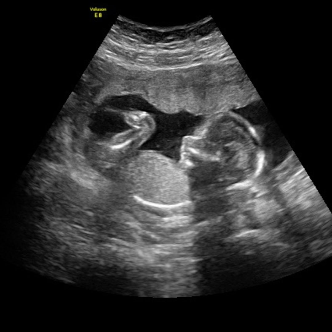 Photo shared by Faith for their Babylist baby registry.