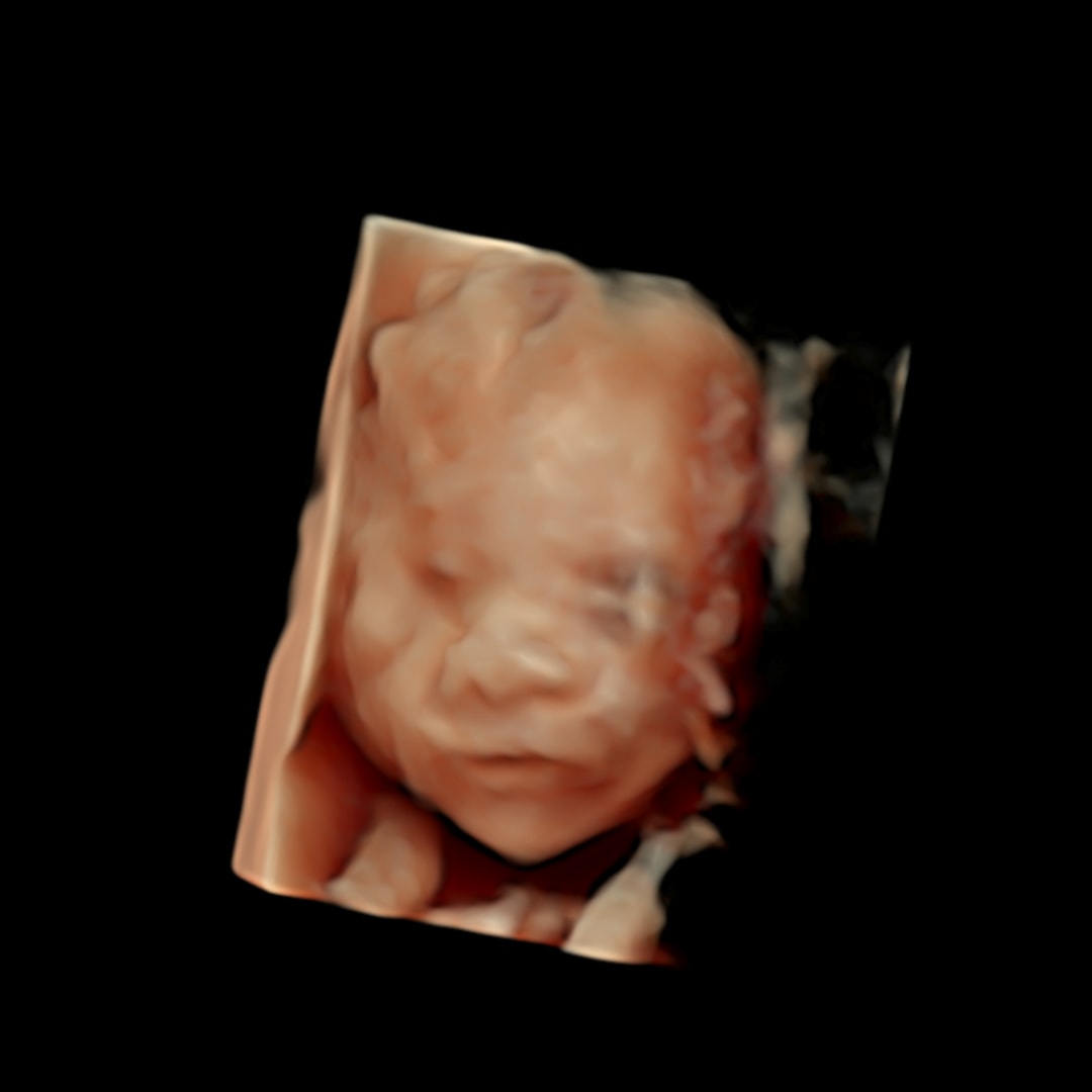 Photo shared by Laura for their Babylist baby registry.