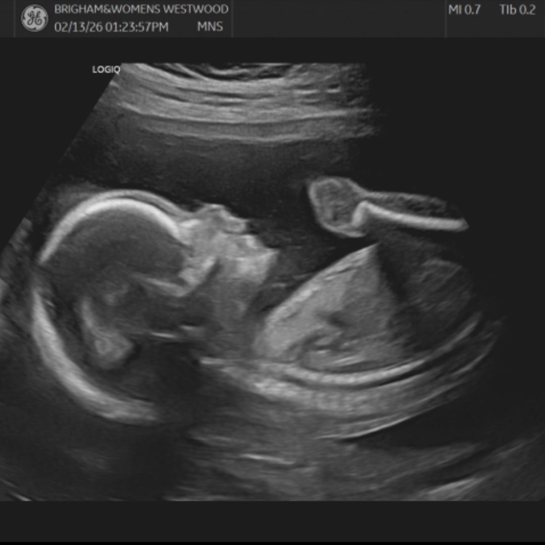 Photo shared by Jess for their Babylist baby registry.