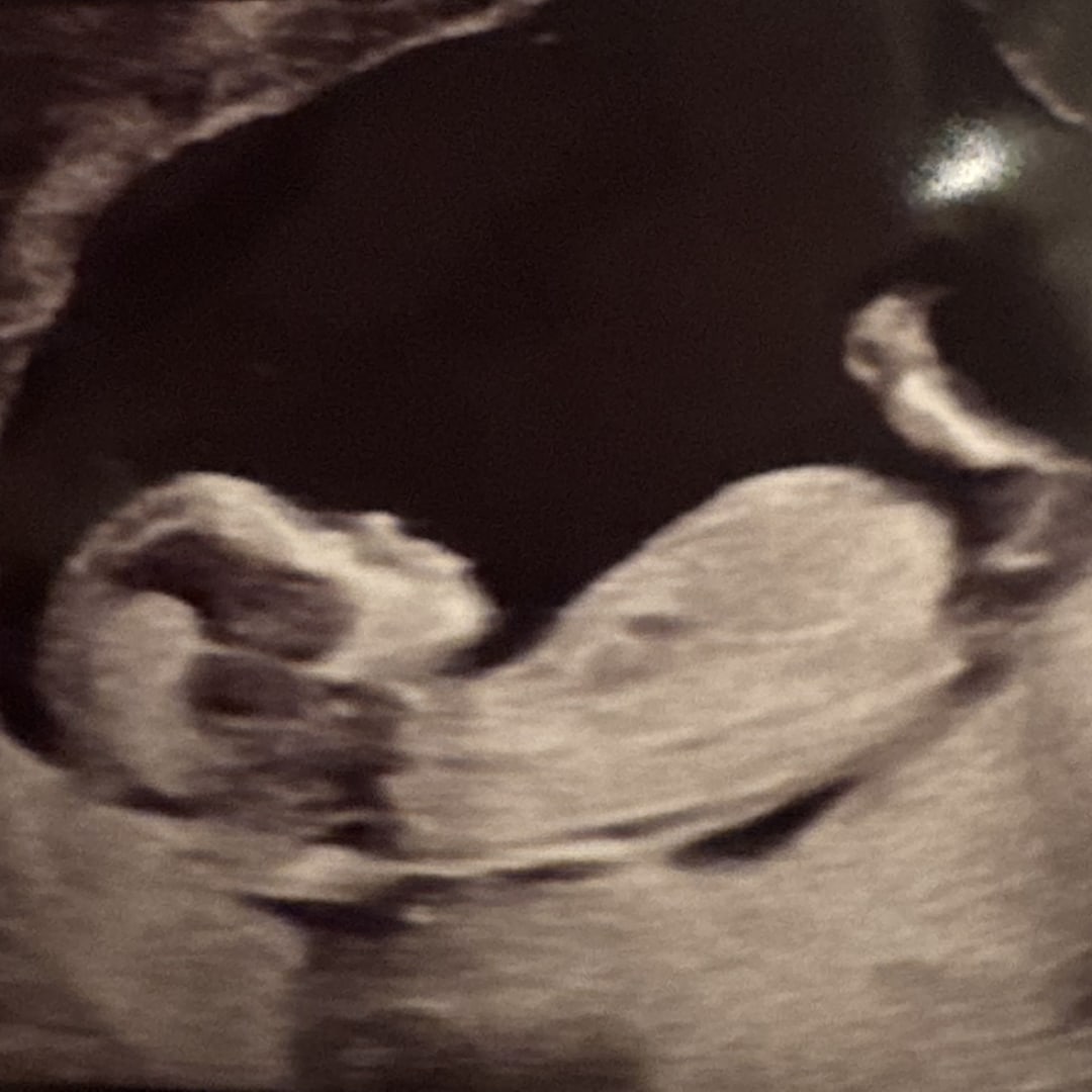 Photo shared by Emily for their Babylist baby registry.