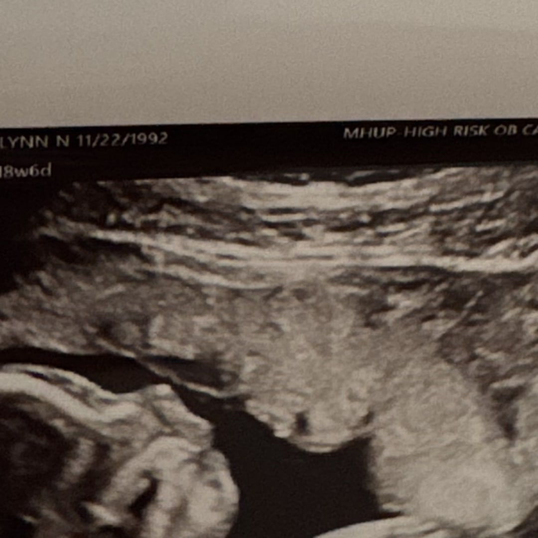 Photo shared by Gracelynn for their Babylist baby registry.