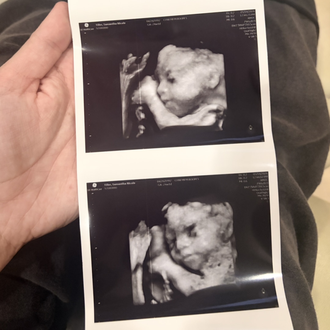 Photo shared by Samantha for their Babylist baby registry.