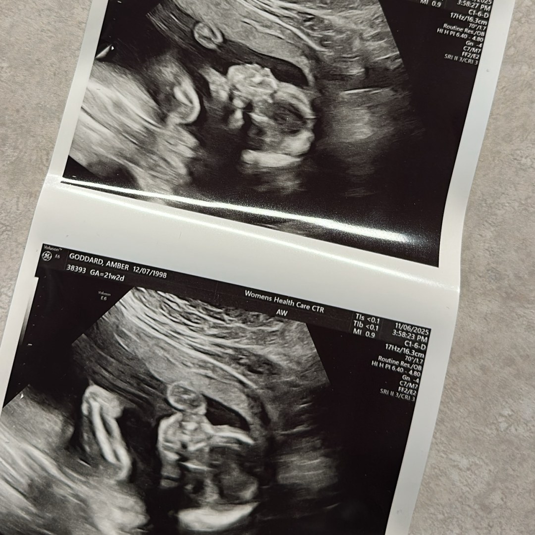 Photo shared by Amber for their Babylist baby registry.