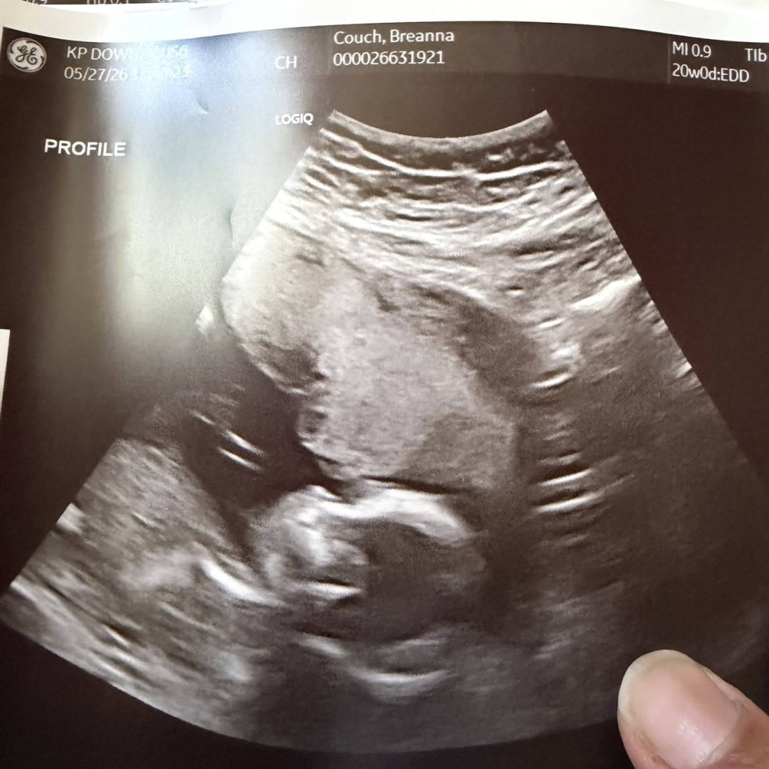 Photo shared by Breanna for their Babylist baby registry.