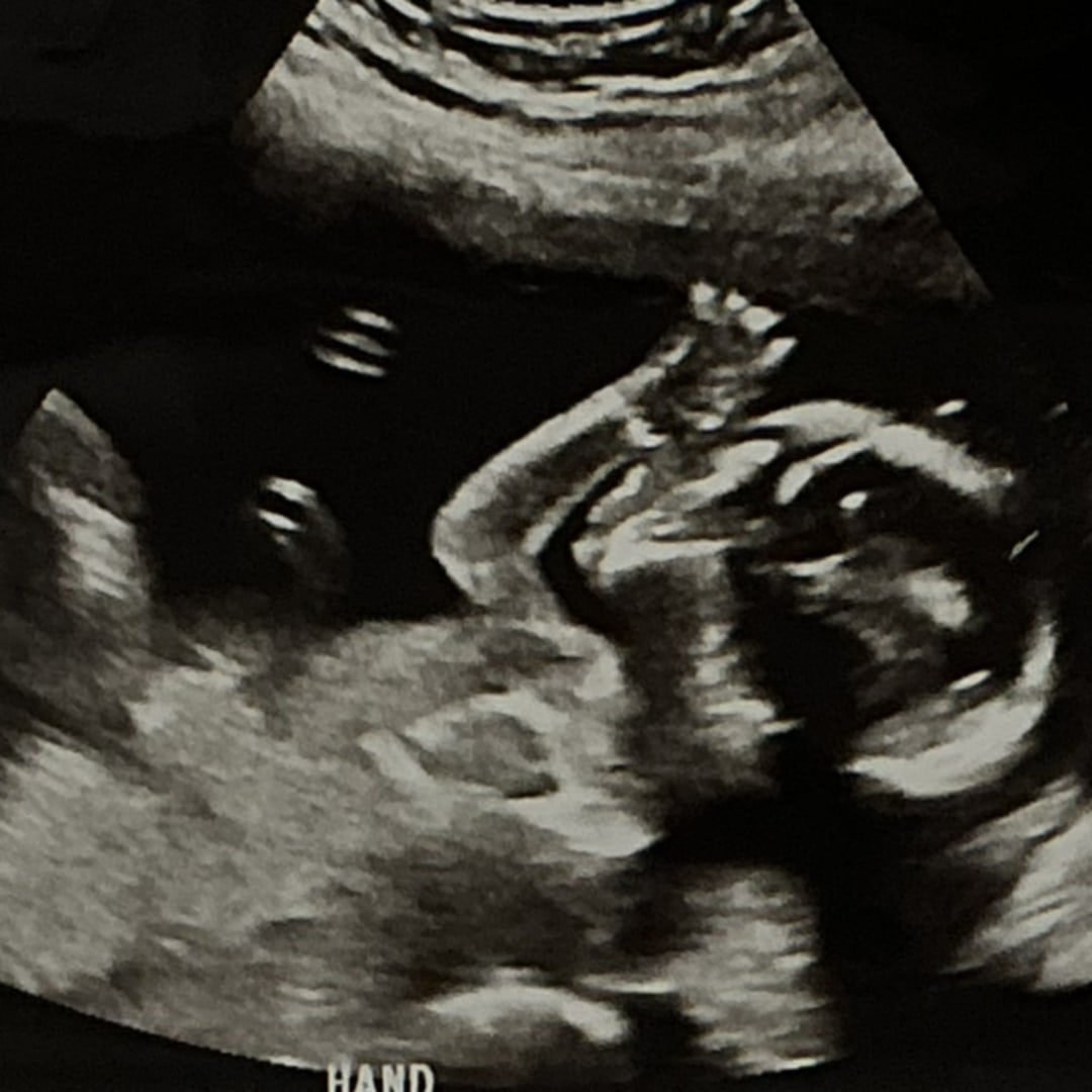 Photo shared by IvyRose for their Babylist baby registry.