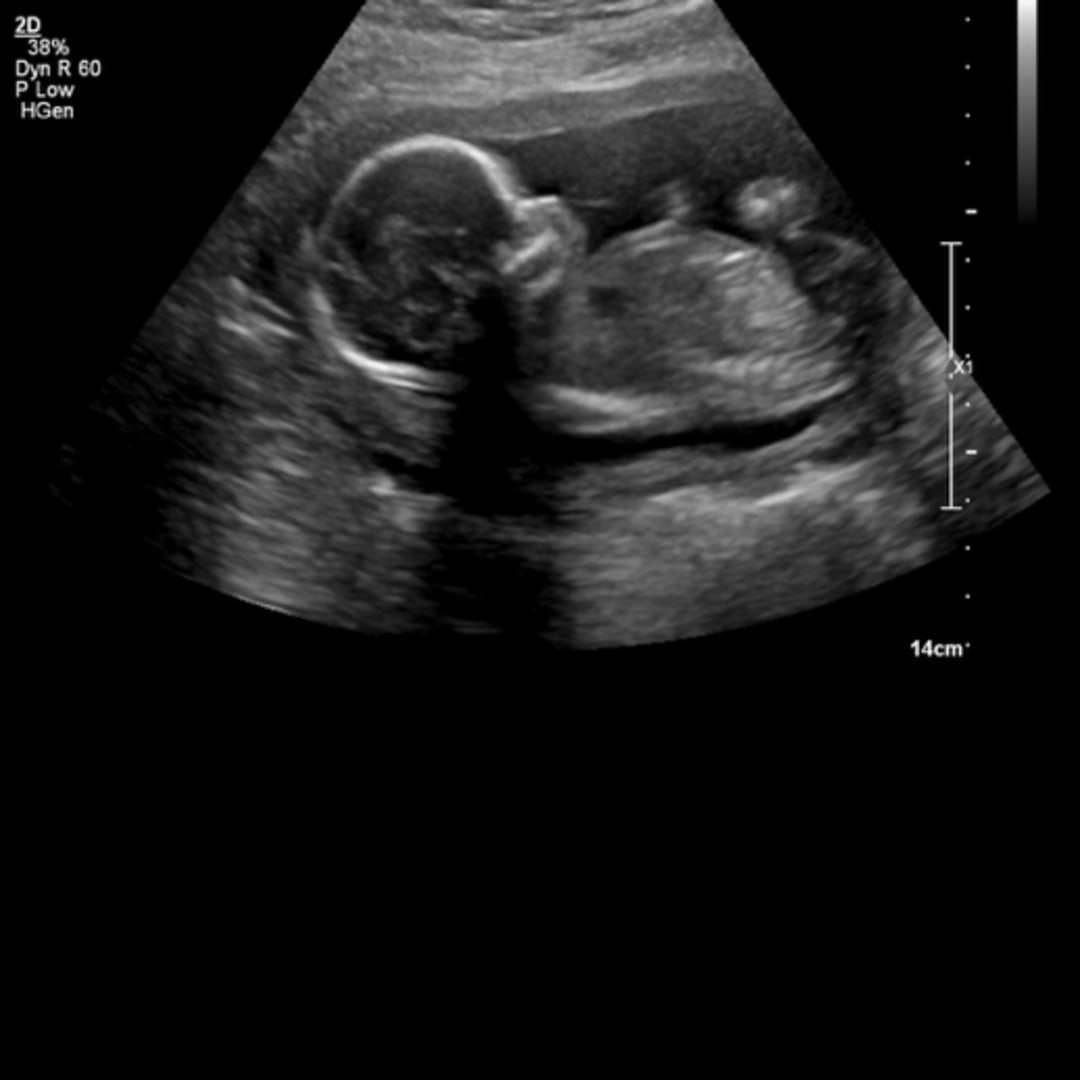 Photo shared by Cheyenne for their Babylist baby registry.