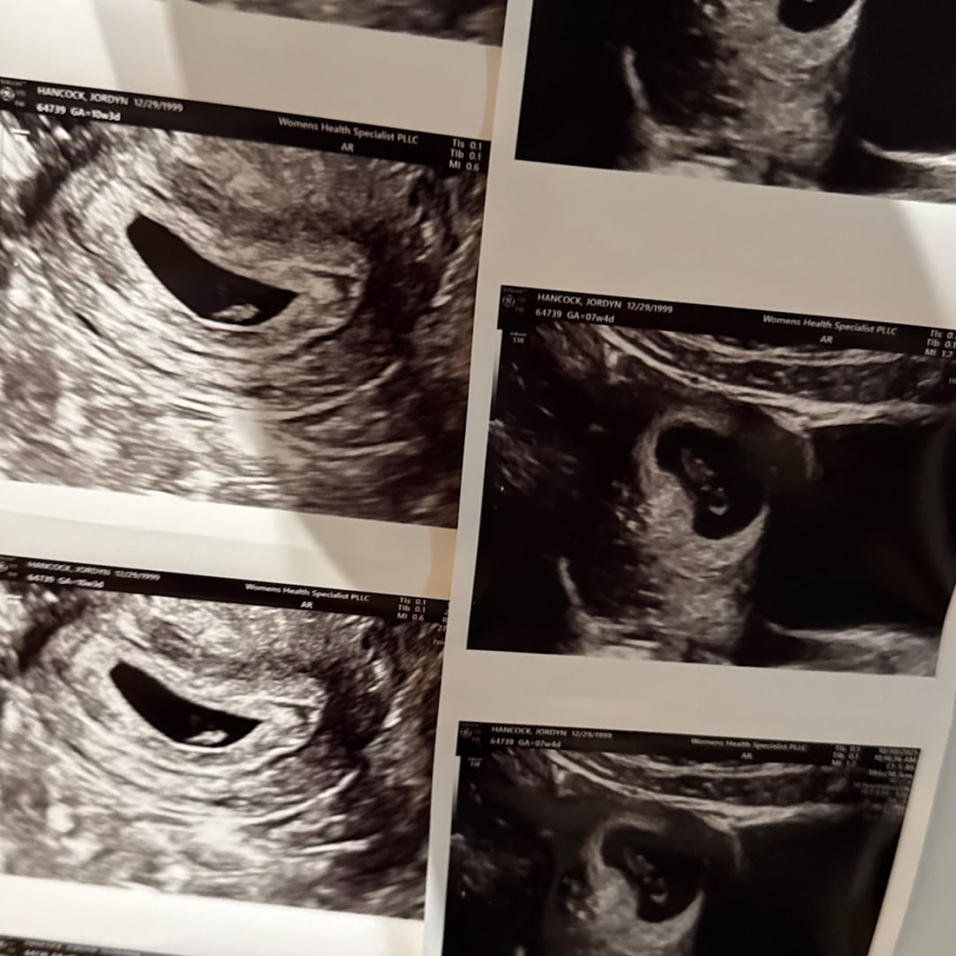 Photo shared by Jordyn for their Babylist baby registry.