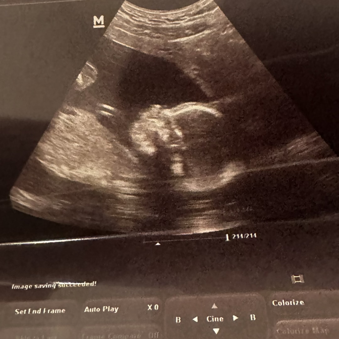 Photo shared by Joy for their Babylist baby registry.