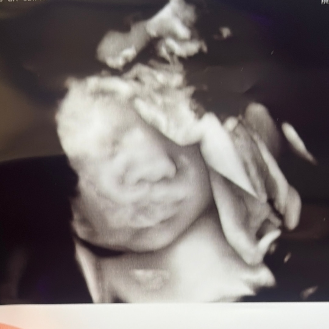 Photo shared by Angela for their Babylist baby registry.