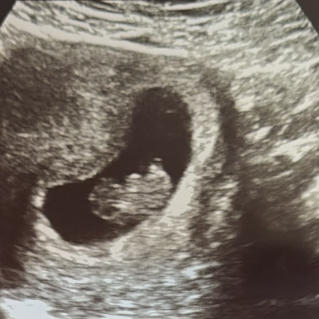 Photo shared by Jillian for their Babylist baby registry.