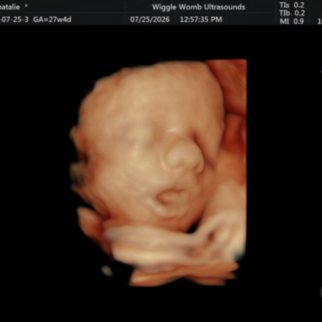 Photo shared by Mattie for their Babylist baby registry.