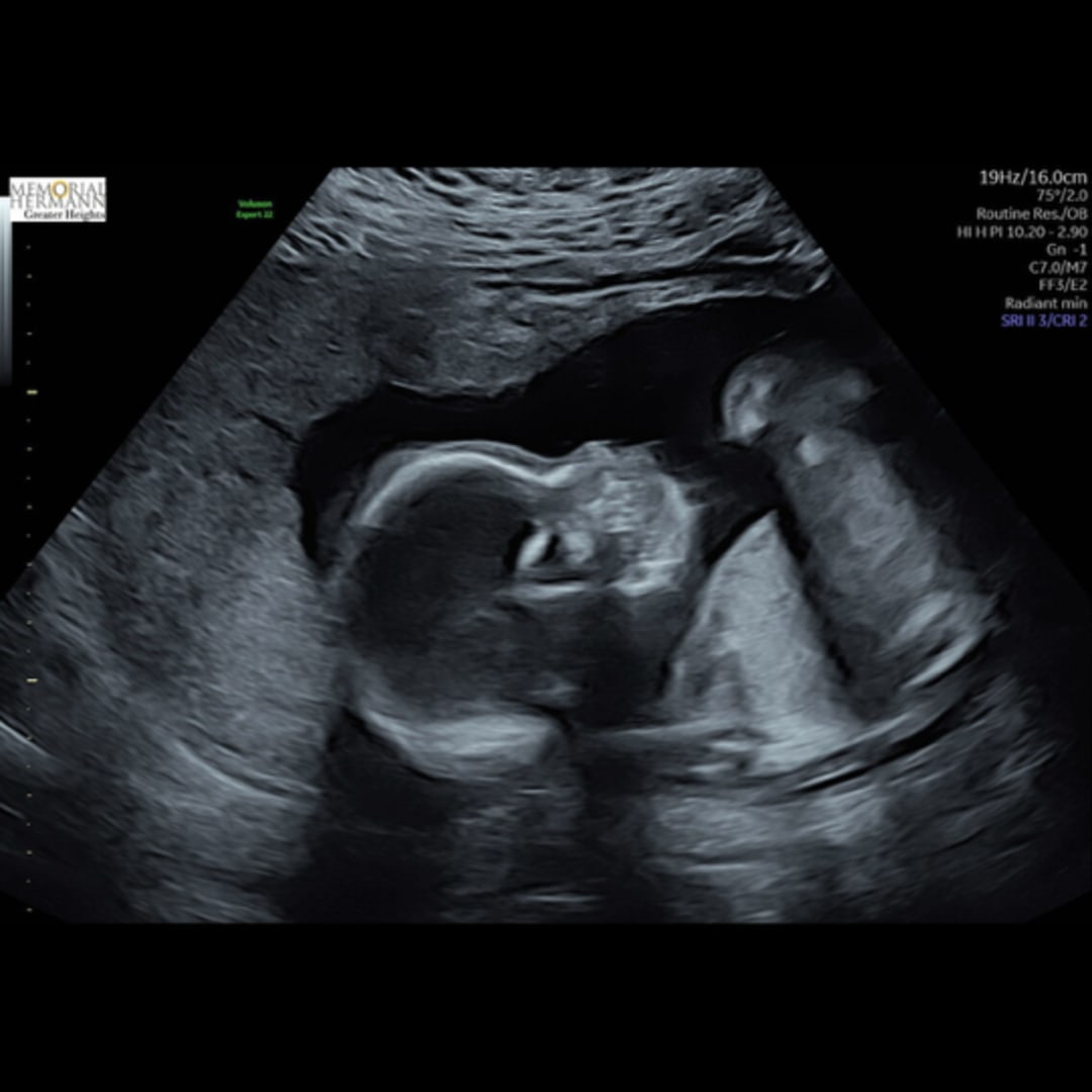 Photo shared by Chetravia for their Babylist baby registry.