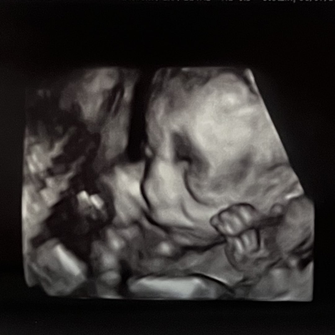 Photo shared by Raven for their Babylist baby registry.