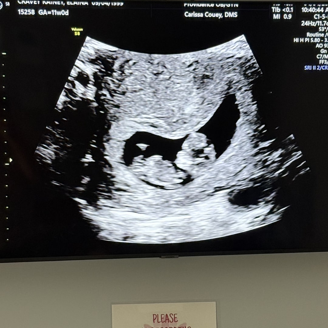 Photo shared by Elaina for their Babylist baby registry.