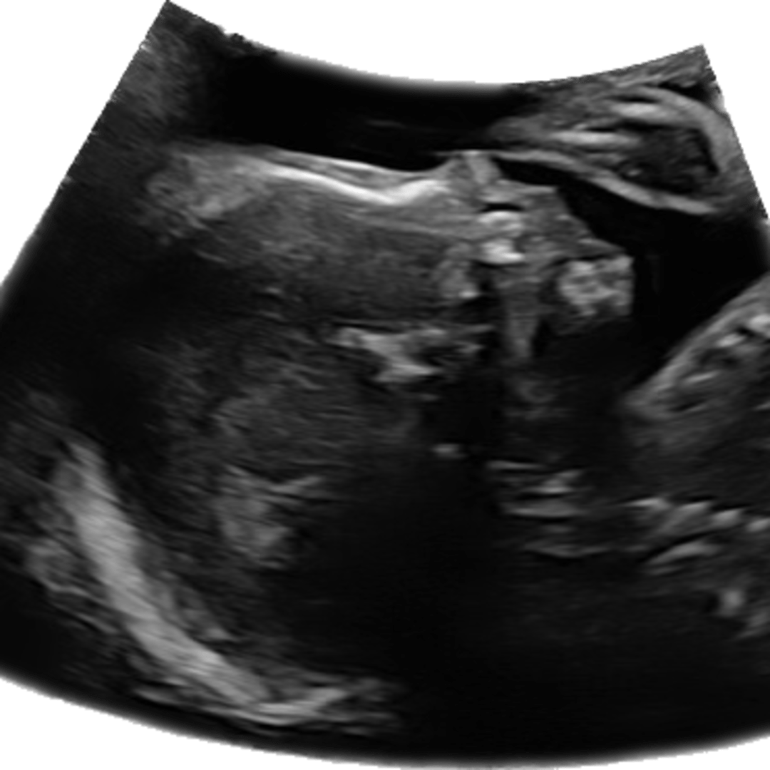 Photo shared by Skyler for their Babylist baby registry.