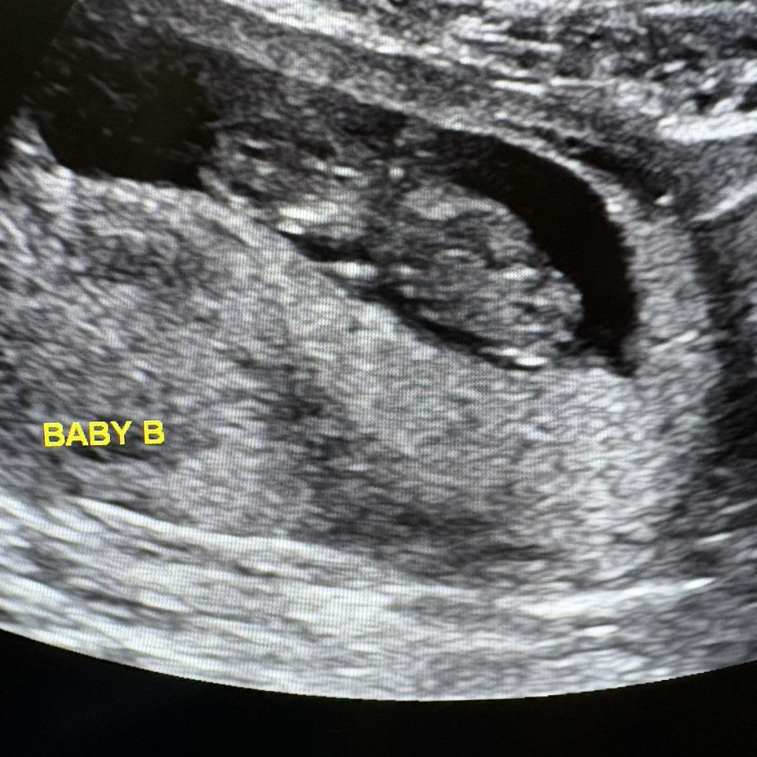 Photo shared by Alyssa for their Babylist baby registry.