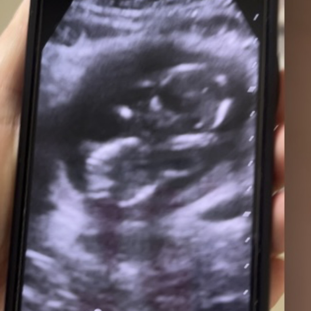 Photo shared by Ashley for their Babylist baby registry.